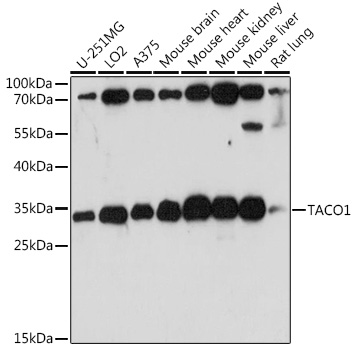 a12159 taco1 primary antiboties wb testing 1