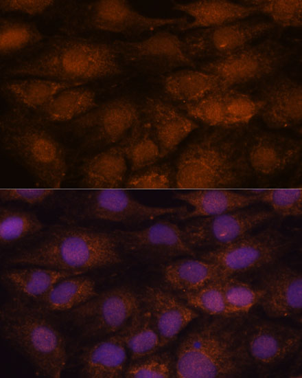 a12164 cep85 primary antiboties if testing 2