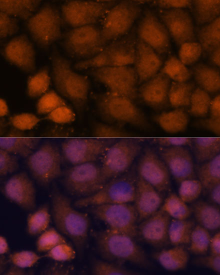 a12164 cep85 primary antiboties if testing 3