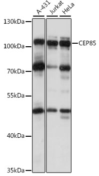 a12164 cep85 primary antiboties wb testing 1
