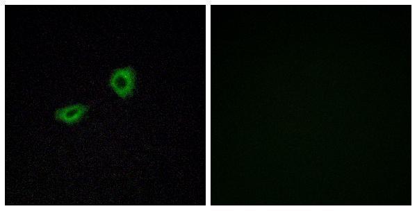 a12171 chrm5 primary antibodies if testing 1