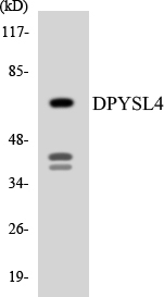 Western blot analysis of the lysates from RAW264
