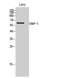 Western Blot analysis of LOVO cells using CRMP-3 Polyclonal Antibody