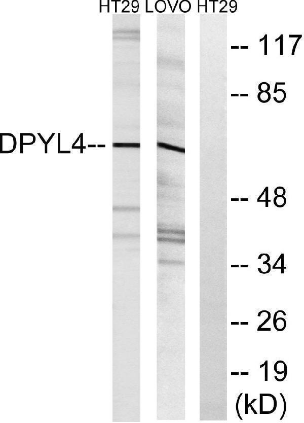 Western blot analysis of lysates from LOVO and HT-29 cells, using DPYSL4 Antibody