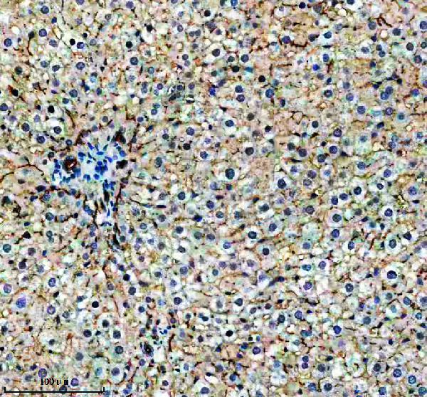a12186 1 tm4sf4 primary antibodies ihc testing 1