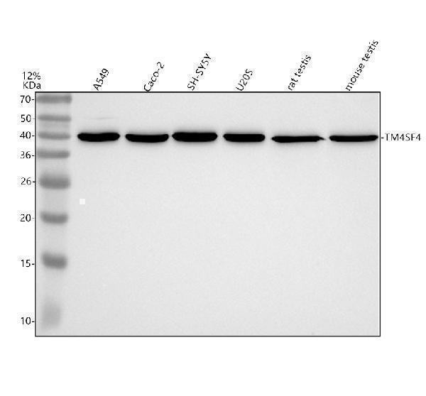 a12186 1 tm4sf4 primary antibodies wb testing 1