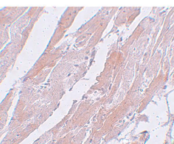 a12188 ccdc47 primary antibodies ihc testing 2