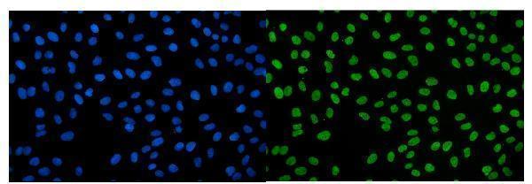 a12191 igf2 as primary antibodies if testing 2