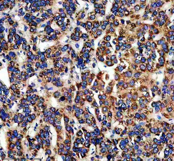 a12195 1 epdr1 primary antibodies ihc testing 1