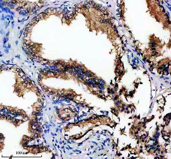 a12195 1 epdr1 primary antibodies ihc testing 2