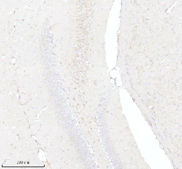 a12195 1 epdr1 primary antibodies ihc testing 3