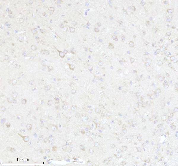 a12195 1 epdr1 primary antibodies ihc testing 4