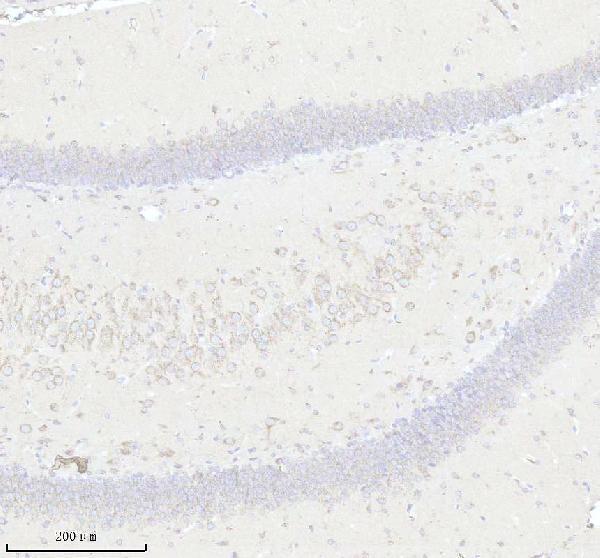 a12195 1 epdr1 primary antibodies ihc testing 5