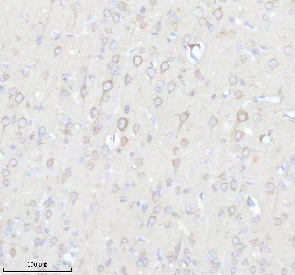 a12195 1 epdr1 primary antibodies ihc testing 6