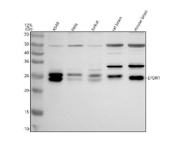 a12195 1 epdr1 primary antibodies wb testing 1
