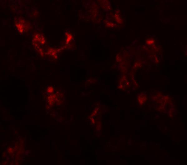 a12200 uhrf1bp1 primary antibodies if testing 4