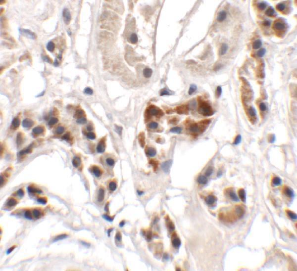 Immunohistochemistry of UHRF1BP1 in human kidney tissue with UHRF1BP1 antibody at 2
