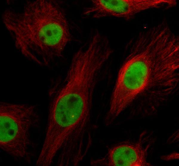 a12204 3 ddx52 primary antibodies if testing 1