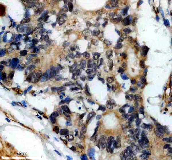 IHC analysis of DDX52 using anti-DDX52 antibody (A12204-3)