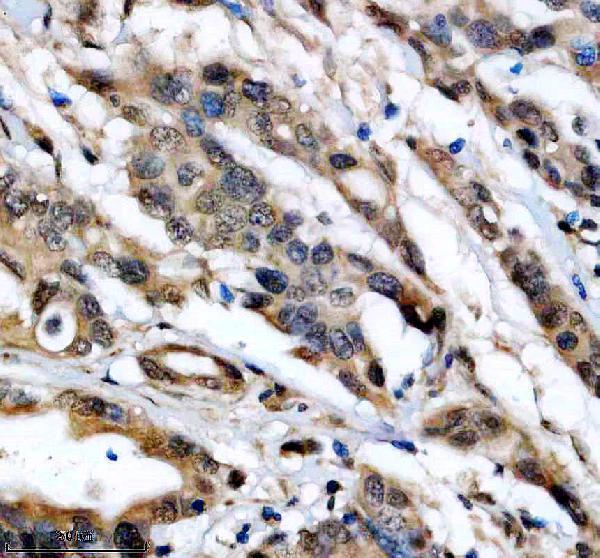 IHC analysis of DDX52 using anti-DDX52 antibody (A12204-3)
