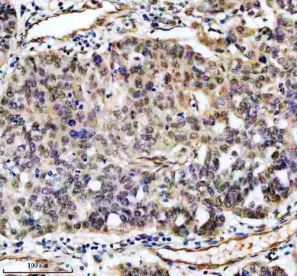 a12204 3 ddx52 primary antibodies ihc testing 3