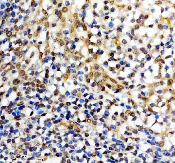 a12204 3 ddx52 primary antibodies ihc testing 4