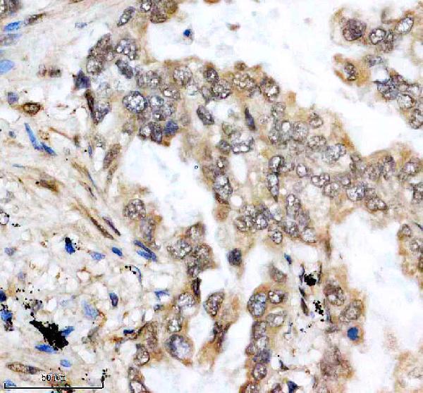 a12204 3 ddx52 primary antibodies ihc testing 5