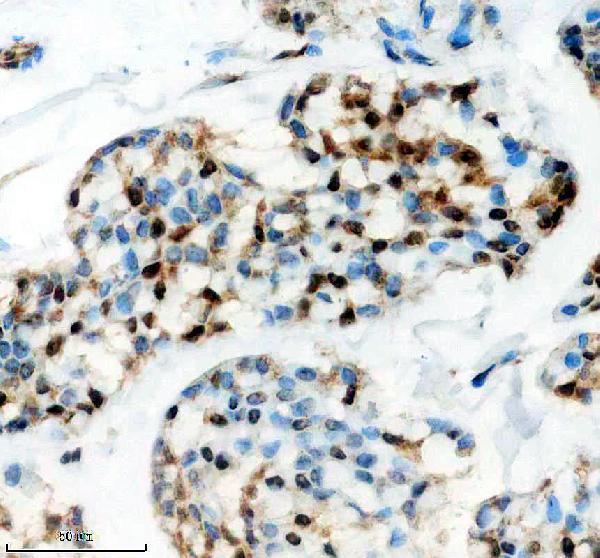a12204 3 ddx52 primary antibodies ihc testing 6