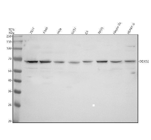 Western blot analysis of DDX52 using anti-DDX52 antibody (A12204-3)