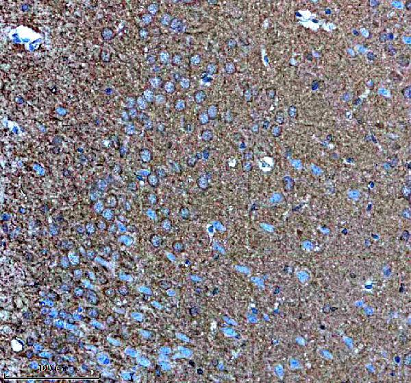 a12206 1 naa35 primary antibodies ihc testing 1