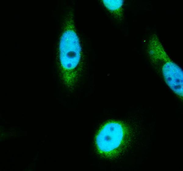 a12209 2 dtymk primary antibodies if testing 1