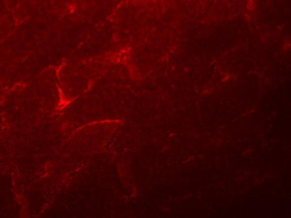 Immunofluorescence of ADAMTSL5 in mouse skeletal muscle tissue with ADAMTSL5 antibody at 20 μg/mL