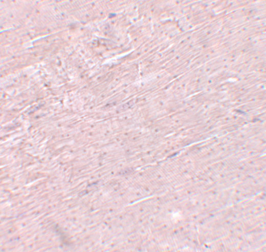 Immunohistochemistry of ADAMTSL5 in mouse skeletal muscle tissue with ADAMTSL5 antibody at 5 μg/mL