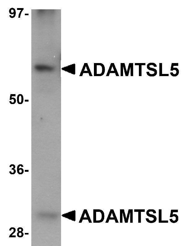 Western blot analysis of ADAMTSL5 in human skeletal muscle tissue lysate with ADAMTSL5 antibody at 1 μg/mL