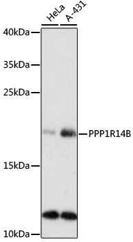 a12211 ppp1r14b primary antiboties wb testing 1