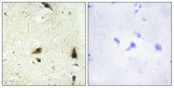 a12215 chrac1 primary antibodies ihc testing 1