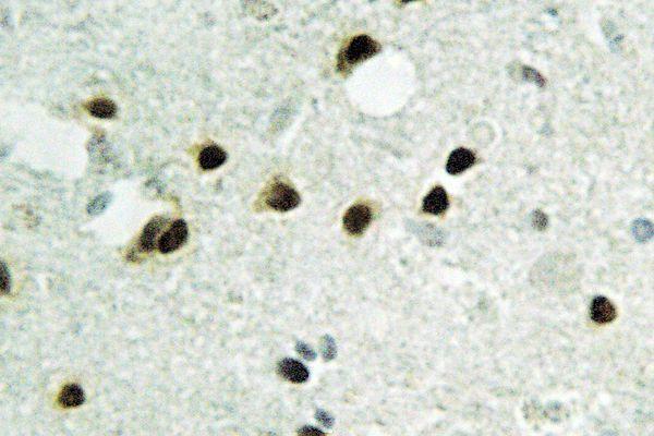a12218 2 hist1h2bh primary antiboties ihc testing 2