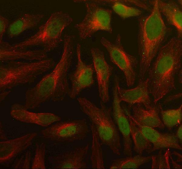  IF analysis of PSMD5 using anti-PSMD5 antibody (A12220-1) and anti-Beta Tubulin antibody (M01857-3)
