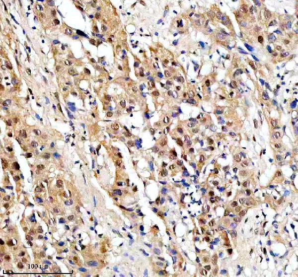  IHC analysis of PSMD5 using anti-PSMD5 antibody (A12220-1)