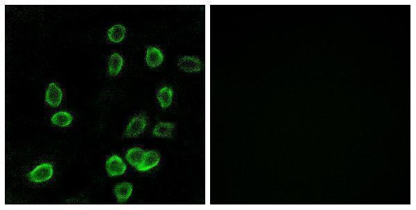 a12221 1 atp5g3 primary antibodies if testing 1