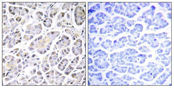 a12221 1 atp5g3 primary antibodies ihc testing 2