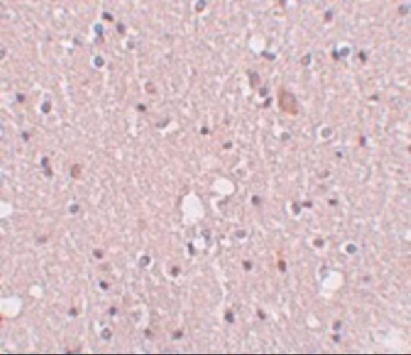 Immunohistochemistry of SIPA1L2 in human brain tissue with SIPA1L2 antibody at 5 μg/mL