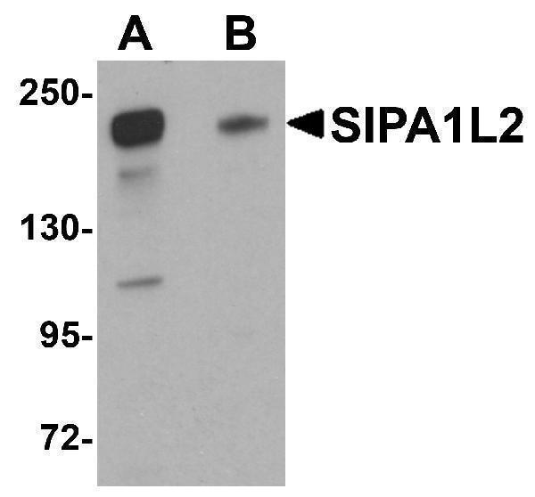 Western blot analysis of SIPA1L2 in rat brain tissue lysate with SIPA1L2 antibody at 1 μg/mL in (A) the absence and (B) the presence of blocking peptide