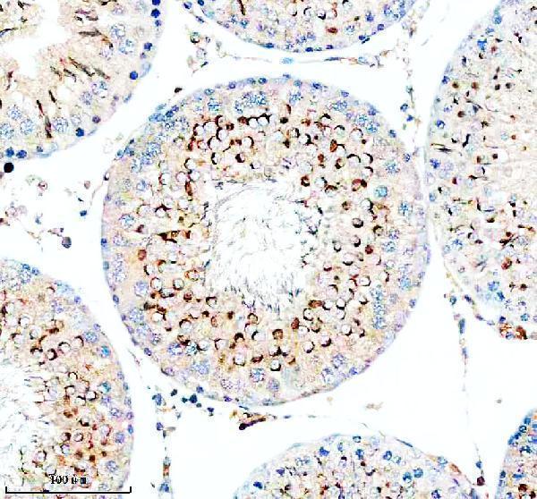 a12228 1 tesmin primary antibodies ihc testing 1