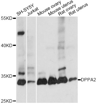 a12232 1 dppa2 primary antiboties wb testing 1