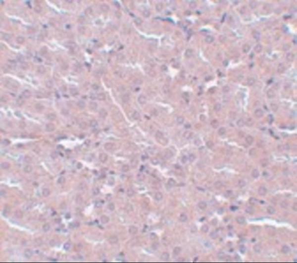 a12236 frmpd2 primary antibodies ihc testing 2