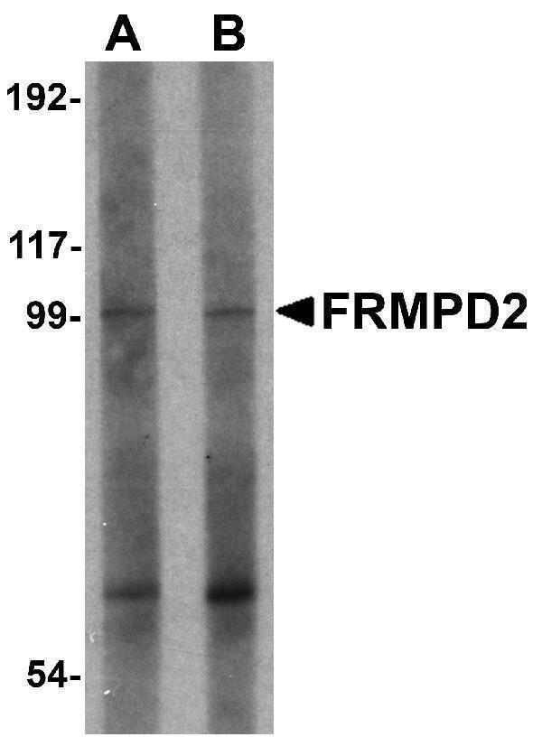 a12236 frmpd2 primary antibodies wb testing 1