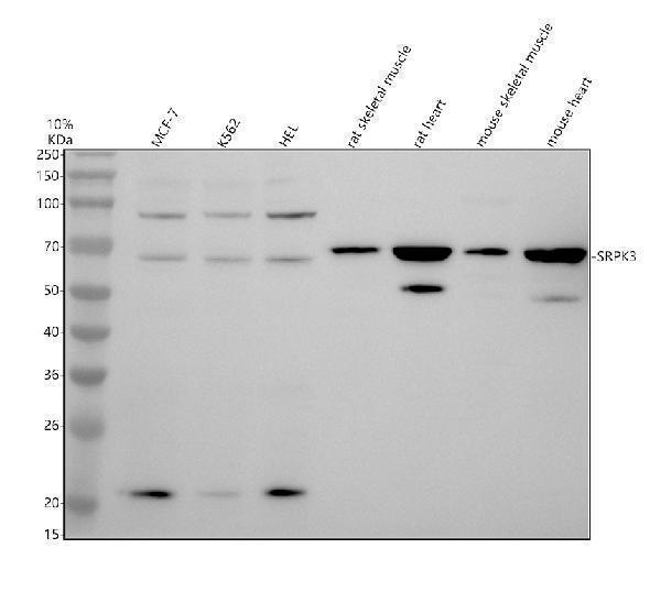 Western blot analysis of SRPK3 using anti-SRPK3 antibody (A12239-1)