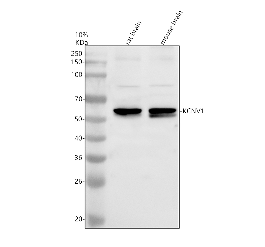 Western blot analysis of KCNV1 using anti-KCNV1 antibody (A12240-2)