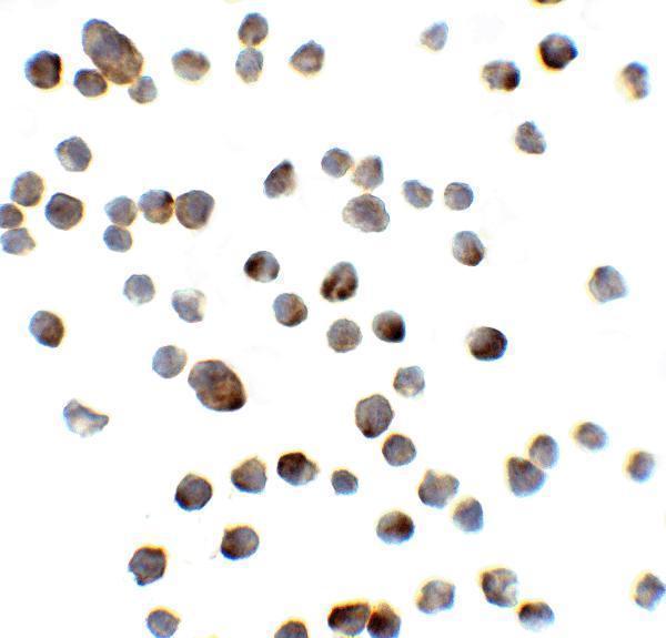 a12243 reep3 primary antibodies icc testing 5